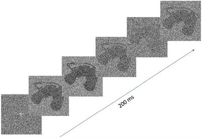 The oscillatory features of visual processing are altered in healthy aging